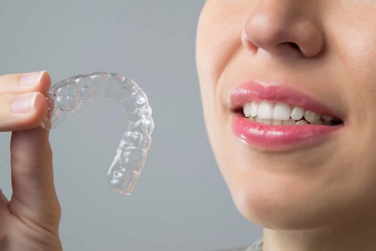 Woman with nice teeth holds invisible braces