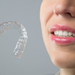 Invisalign braces are effective and invisible