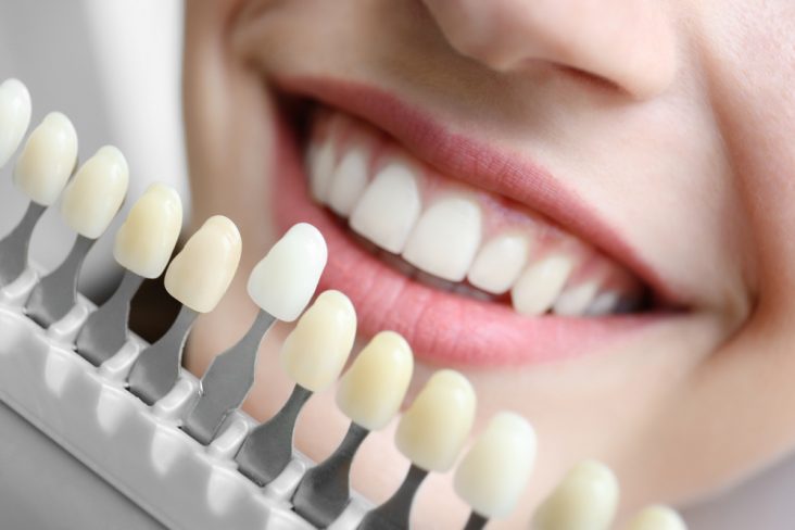 Cosmetic Dental Treatment Explained